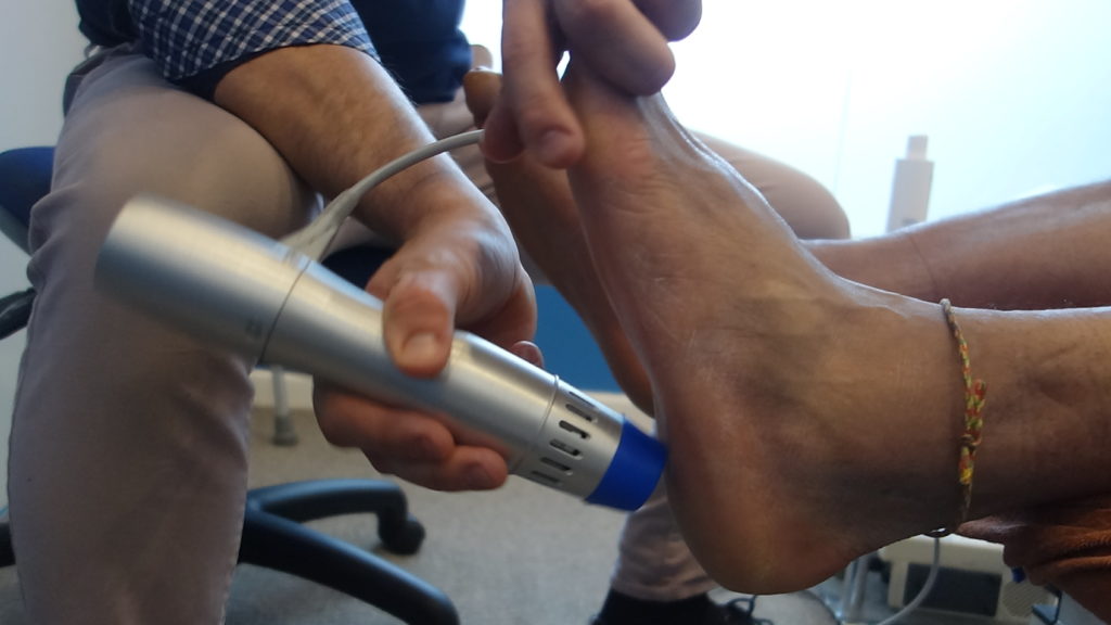 Shockwave therapy treatment on foot