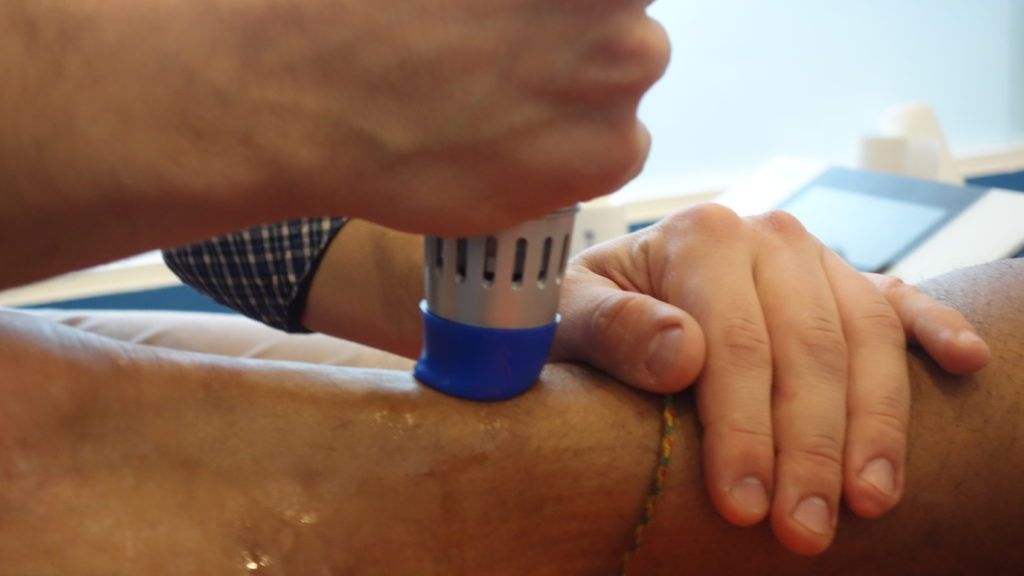 Shockwave Therapy in Brighton