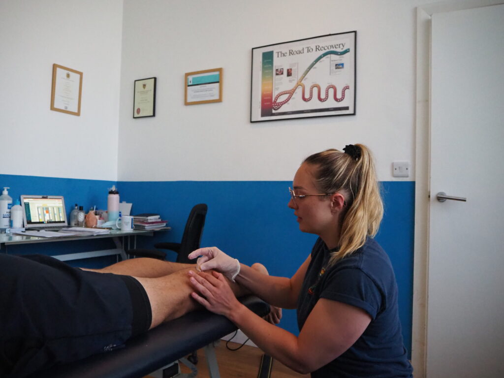 Women performing acupuncture on a calf muscle in a Brighton clinic